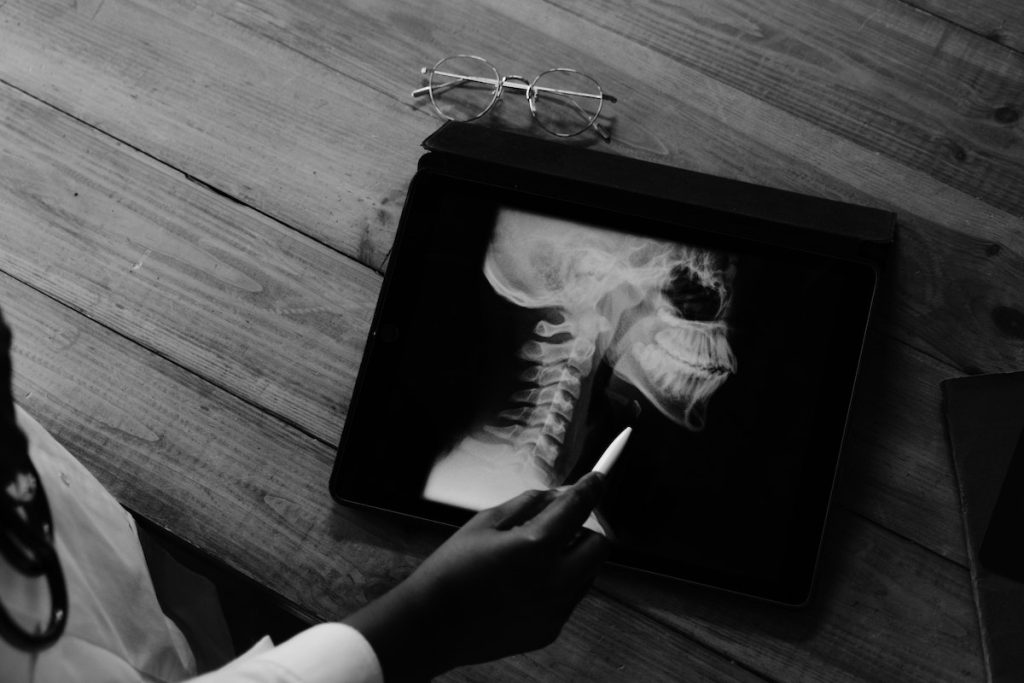 x-ray viewed in tablet